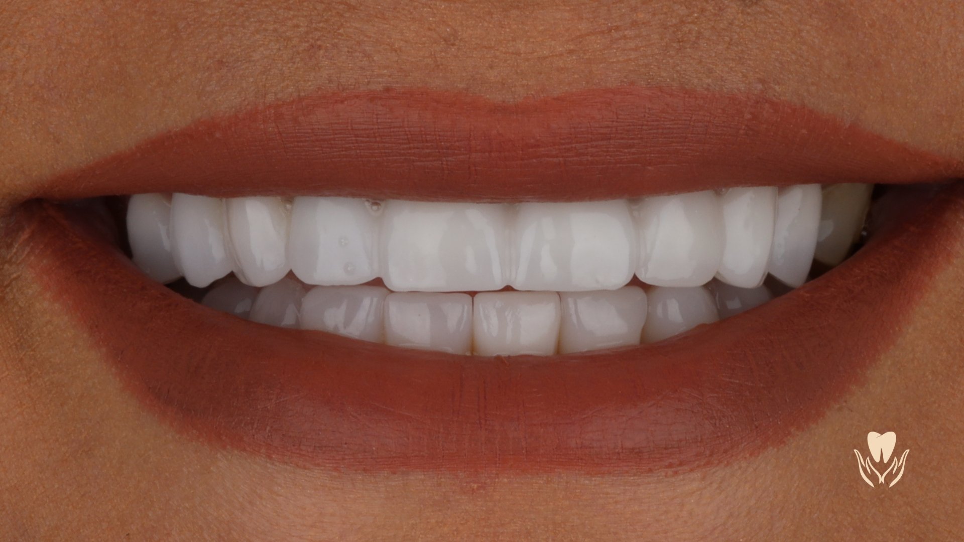 Estetica dentare